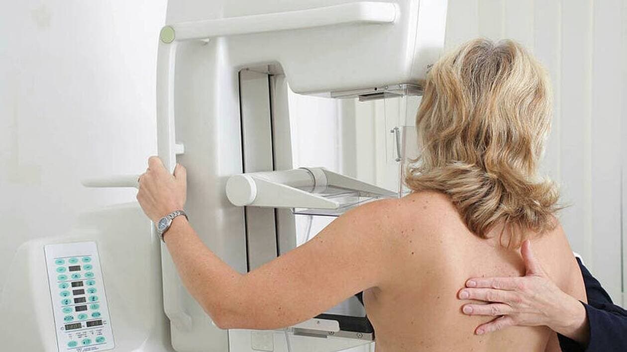 Comment se déroule une mammographie ?